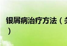 銀屑病治療方法（關(guān)于銀屑病治療方法的介紹）