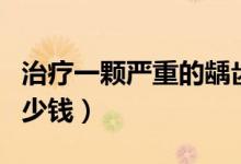 治療一顆嚴(yán)重的齲齒多少錢(qián)（治療一個(gè)齲齒多少錢(qián)）