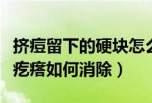 擠痘留下的硬塊怎么消除（擠痘腫了成一個硬疙瘩如何消除）