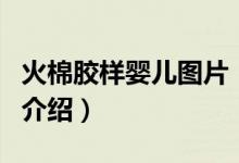 火棉膠樣嬰兒圖片（關于火棉膠樣嬰兒圖片的介紹）