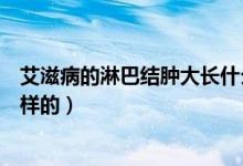 艾滋病的淋巴結(jié)腫大長什么樣（艾滋病的淋巴結(jié)腫大是什么樣的）