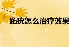 跖疣怎么治療效果最好（跖疣怎么根治）