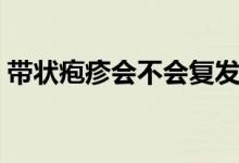 帶狀皰疹會(huì)不會(huì)復(fù)發(fā)啊（帶狀皰疹會(huì)死人嗎）
