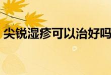 尖銳濕疹可以治好嗎（尖銳濕疹可以治好嗎）