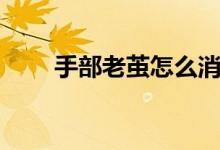 手部老繭怎么消除（老繭怎么消除）