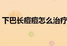 下巴長痘痘怎么治療（下巴長痘痘怎么治療）