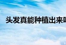 頭發(fā)真能種植出來嗎（頭發(fā)真可以種植嗎）