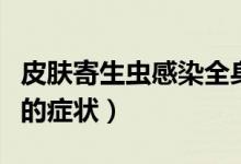 皮膚寄生蟲感染全身性瘙癢（皮膚寄生蟲感染的癥狀）