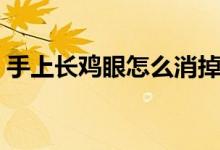 手上長雞眼怎么消掉（手上長雞眼怎么消除）