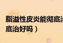 脂溢性皮炎能徹底治療好嗎（脂溢性皮炎能徹底治好嗎）