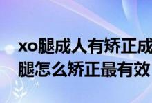 xo腿成人有矯正成功的案例嗎（中學(xué)生xo型腿怎么矯正最有效）