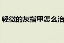 輕微的灰指甲怎么治（輕微的灰指甲怎么治）