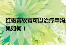 紅霉素軟膏可以治療甲溝炎么（紅霉素軟膏治療甲溝炎的效果如何）