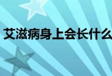 艾滋病身上會長什么（艾滋病身上會長什么）