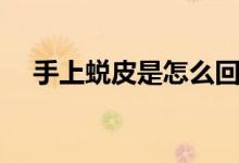 手上蛻皮是怎么回事（為什么手上蛻皮）