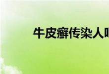 牛皮癬傳染人吧（牛皮癬傳染不）