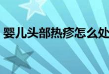 嬰兒頭部熱疹怎么處理（嬰兒熱疹怎么處理）