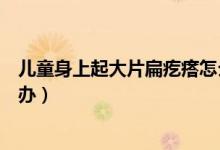 兒童身上起大片扁疙瘩怎么治（兒童身上起大片扁疙瘩怎么辦）