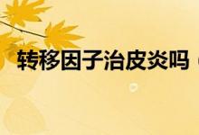轉(zhuǎn)移因子治皮炎嗎（轉(zhuǎn)移因子治皮膚病嗎）