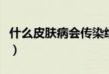 什么皮膚病會傳染給別人（什么皮膚病會傳染）