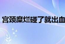 宮頸糜爛碰了就出血嗎（宮頸糜爛會(huì)出血嗎）