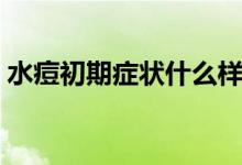 水痘初期癥狀什么樣（水痘初期有哪些癥狀）