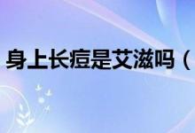 身上長(zhǎng)痘是艾滋嗎（身上有痘痘是艾滋病嗎）