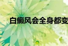 白癜風(fēng)會全身都變白嗎（白癜風(fēng)會死嗎）