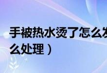 手被熱水燙了怎么發(fā)朋友圈(手被熱水燙了怎么處理)