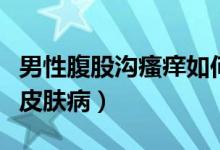 男性腹股溝瘙癢如何治療（腹股溝瘙癢是什么皮膚?。?class=