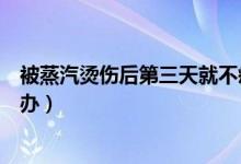 被蒸汽燙傷后第三天就不疼了會(huì)留疤嗎（被蒸汽燙傷后怎么辦）