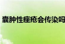 囊腫性痤瘡會傳染嗎（囊腫性痤瘡會自愈嗎）