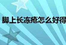 腳上長(zhǎng)凍瘡怎么好得快（腳上長(zhǎng)凍瘡的癥狀）