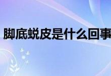 腳底蛻皮是什么回事（腳底蛻皮是什么原因）