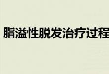 脂溢性脫發(fā)治療過程視頻（脂溢性脫發(fā)治療）