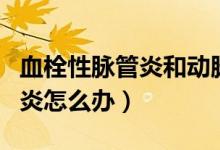 血栓性脈管炎和動脈硬化閉塞癥（血栓性脈管炎怎么辦）