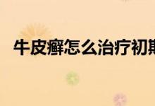 牛皮癬怎么治療初期（牛皮癬初期怎么辦）