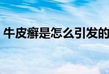 牛皮癬是怎么引發(fā)的（牛皮癬是什么引起的）