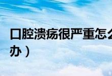 口腔潰瘍很嚴(yán)重怎么治（口腔潰瘍很嚴(yán)重怎么辦）
