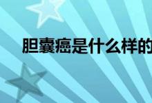 膽囊癌是什么樣的（dna是什么的縮寫）