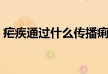 瘧疾通過(guò)什么傳播痢疾（瘧疾通過(guò)什么傳播）