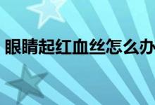 眼睛起紅血絲怎么辦（眼睛起紅血絲怎么辦）