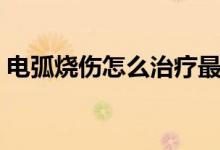 電弧燒傷怎么治療最快（電弧燒傷怎么處理）
