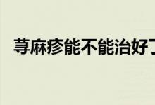 蕁麻疹能不能治好了（蕁麻疹能不能根治）