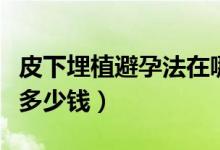 皮下埋植避孕法在哪些地方（皮下埋植避孕法多少錢）