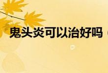 鬼頭炎可以治好嗎（鬼頭炎癥用什么軟膏）