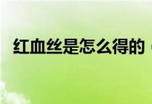 紅血絲是怎么得的（紅血絲是怎么形成的）