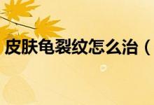 皮膚龜裂紋怎么治（皮膚龜裂應(yīng)該怎樣護理）