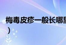 梅毒皮疹一般長哪里（梅毒皮疹一般長在哪里）