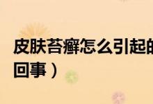 皮膚苔癬怎么引起的（初級苔蘚皮膚病是怎么回事）